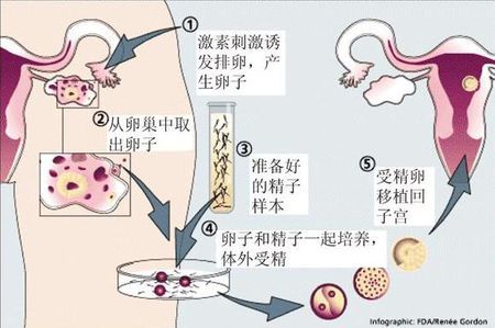 案例